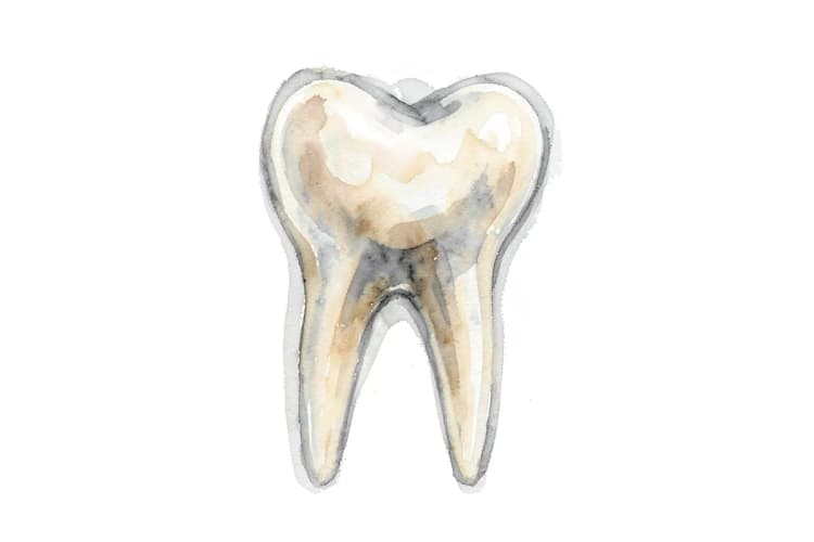 Radiografia de um dente com sinais de infecção na raiz
