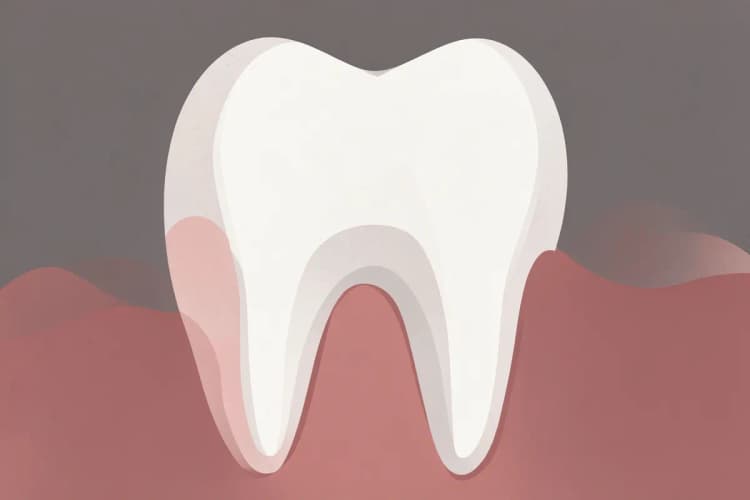 Close-up de um dente com cárie profunda e inchaço na gengiva