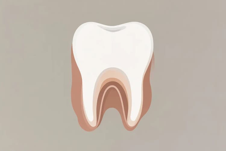 Dente com inflamação visível ao redor da raiz em uma ilustração odontológica.