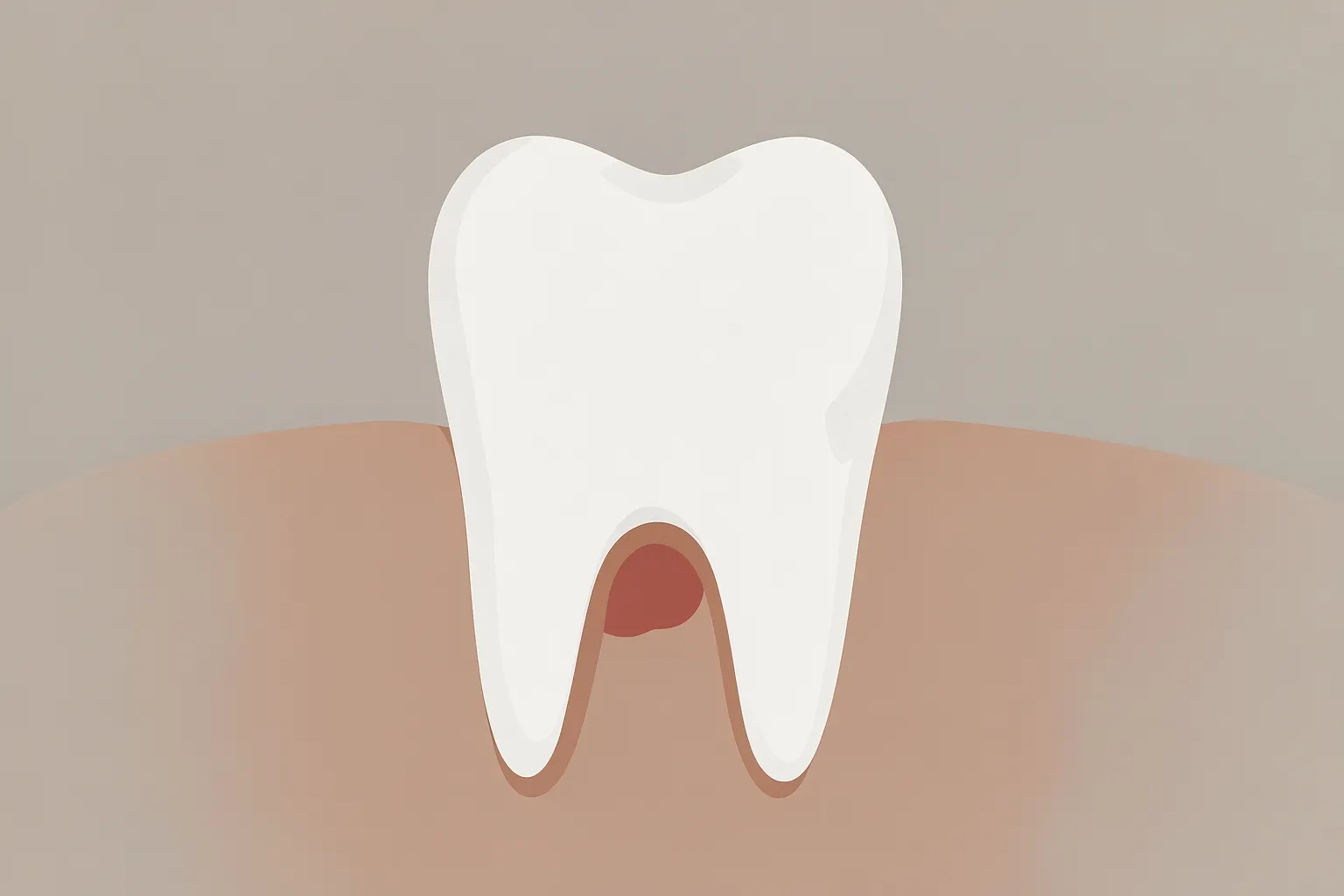 Close-up de um dente com uma pequena protuberância vermelha e inchada na gengiva ao lado, indicando uma fístula.