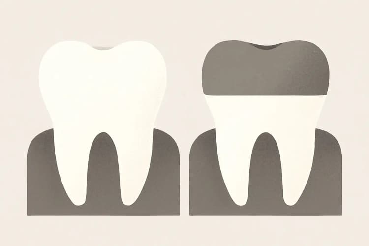 Dente saudável ao lado de um dente tratado